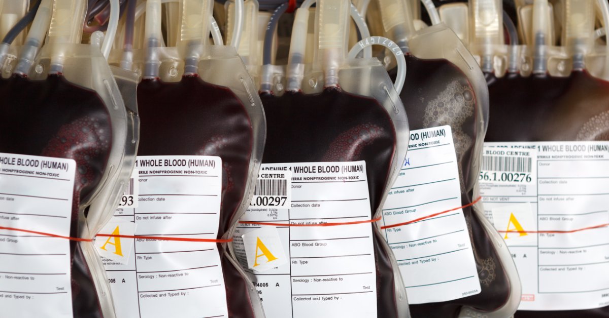 The Importance of Temperature Monitoring for Blood Banks A row of labeled whole blood bags with attached tubing and collection components arranged for storage.